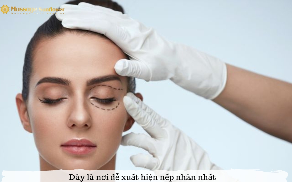 Đây là nơi dễ xuất hiện nếp nhăn