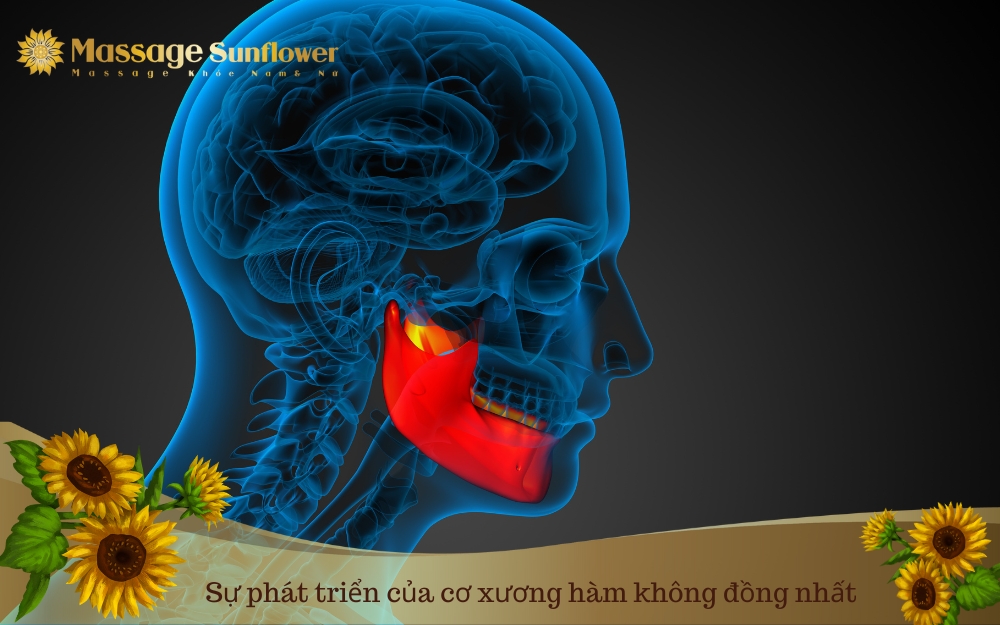 Su phat trien cua co xuong ham khong dong nhat