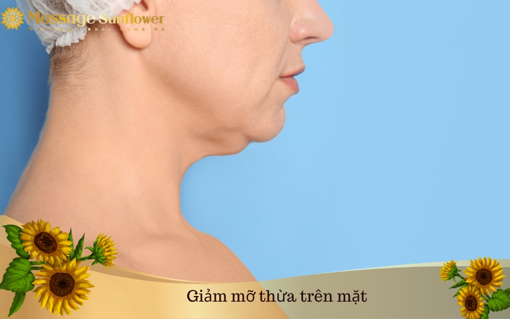 Giảm mỡ thừa trên mặt